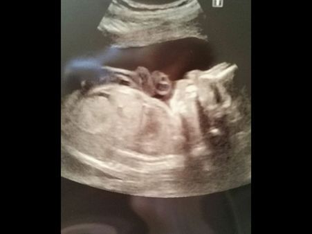 Since 3 Years, He Was Under This Transition…