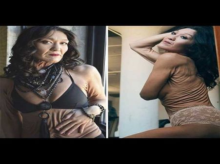 The Condition Makes Her Skin Look Old