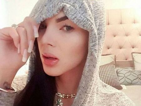 She Underwent Her First Surgery At The Age Of 18!