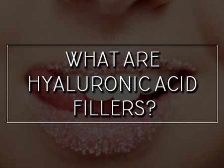 What Are Hyaluronic Acid Fillers? What Are Hyaluronic Acid Fillers?