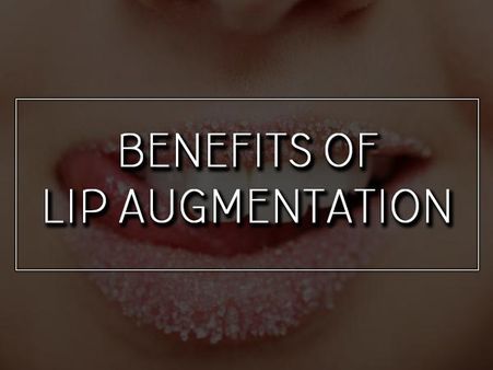 Benefits Of Lip Augmentation Benefits Of Lip Augmentation