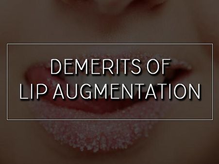 Demerits Of The Lip Augmentation Process Demerits Of The Lip Augmentation Process