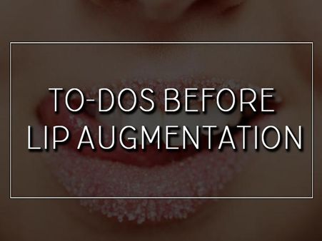 To-Dos Before Lip Augmentation To-Dos Before Lip Augmentation