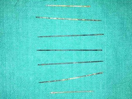 Will Things Ever Change? 