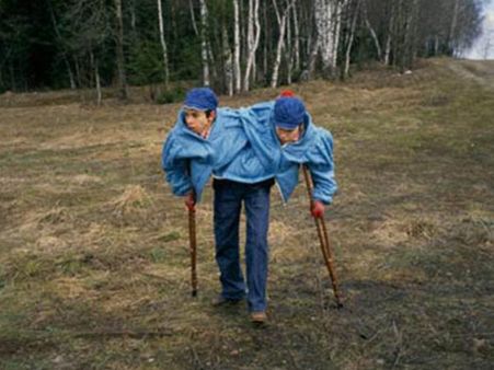 Masha Refused Surgery While Dasha Wanted It…