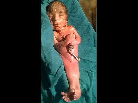 The Condition Of The Baby…