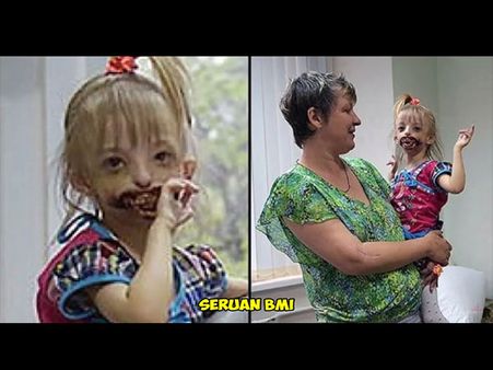 The Kid Had A Serious Face Disorder…