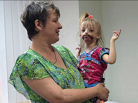 The Parents Fought For Her…