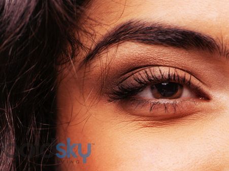 8. Eye Puffiness: 8. Eye Puffiness: