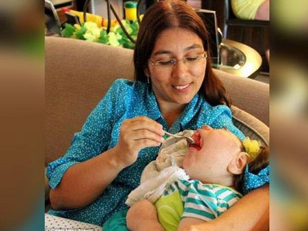 Her Facial Features Were Displaced... 