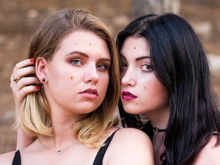 Long-lasting Pimple Or Boil Long-lasting Pimple Or Boil