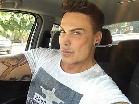 The Condition Is Known As…