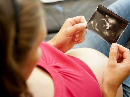 Does It Cause Birth Defects?