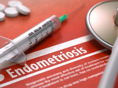 2) Helps Those Suffering From Endometriosis: 