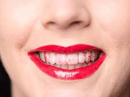 Don't Eat Away Your Lip Colour