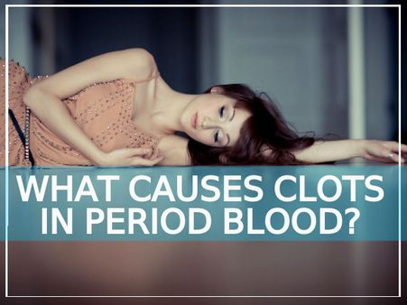 Why Do Clots Form?
