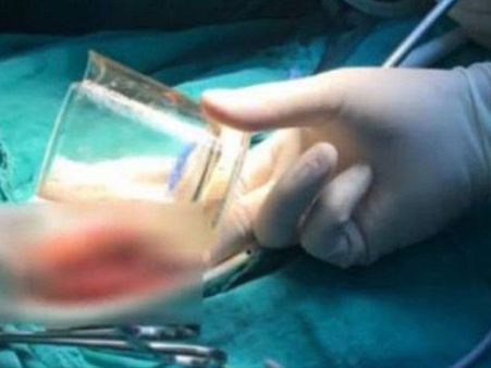 He Had To Be Operated…