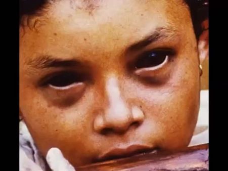 She Started Hallucinating On Her Final Day... She Started Hallucinating On Her Final Day...