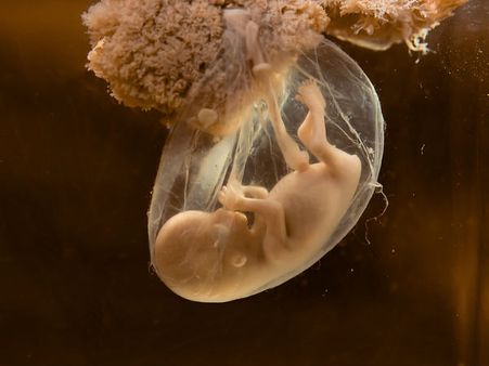 What Actually Happens When The Baby Is Not Born?