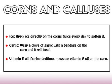 Corns And Calluses