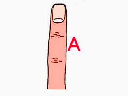Type 'A' Finger Type 'A' Finger