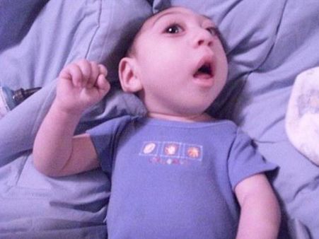 Baby Without A Brain!