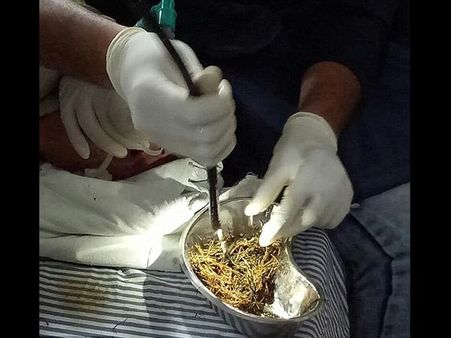 He Suffered From Pica