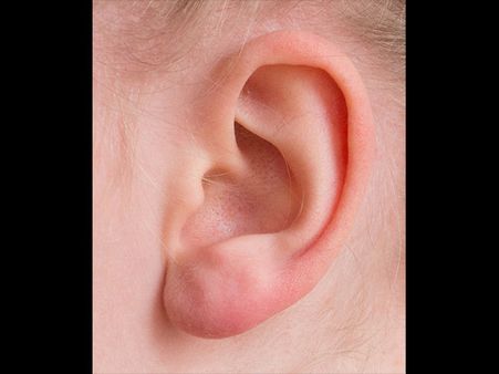 She Was Finally Operated