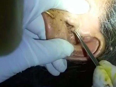 The Fly Did The Needful