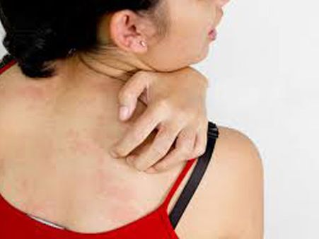 6. People With Infections 