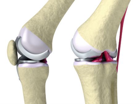 5. Improves Bone Health: