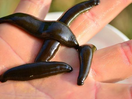 Inserting Leeches In The Vagina