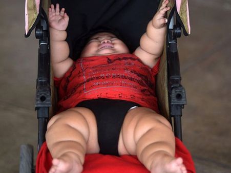 He Was Born As A Regular Healthy Kid