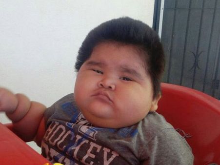 He Suffers From A Rare Condition