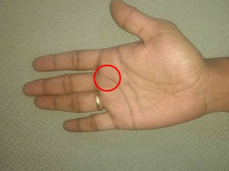 If It Meets The Head Line