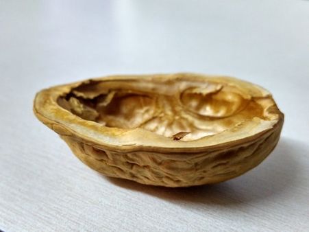 #18 It can protect your brain from dementia and Alzheimer’s.