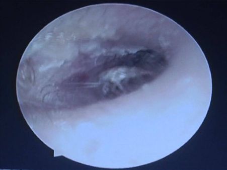 The Man Complained Of Ear Ache…