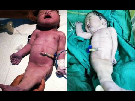 The Baby Was Born In India….