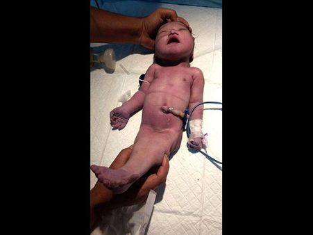 The Gender Of The Baby Remained A Mystery!