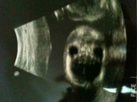 Picture#8 The Tricky Baby Picture!