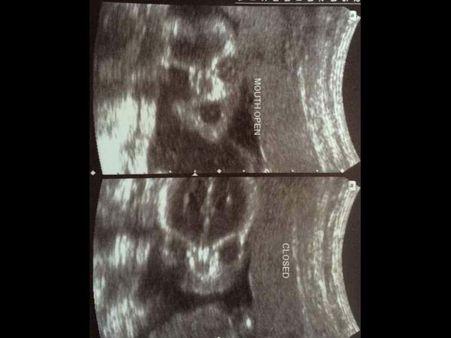 Picture#4 The Poser!