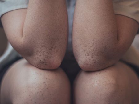 #4 Massage Your Knee 