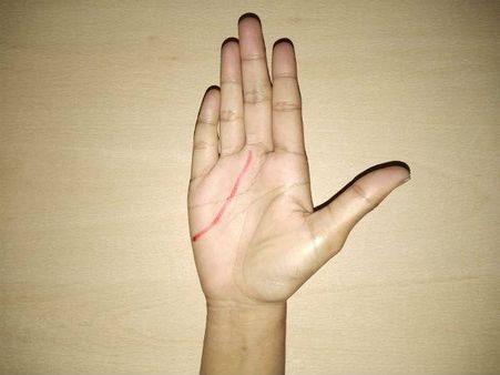 The Other Markings…