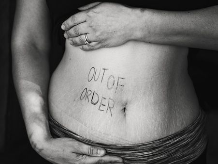 #9 Regular reflux of stomach acid after meals.