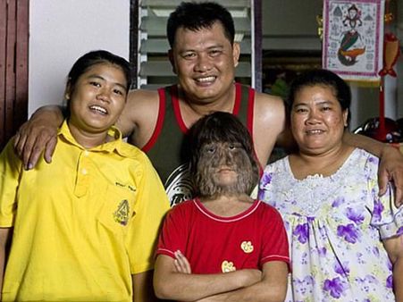 Various Treatments Failed… Various Treatments Failed…