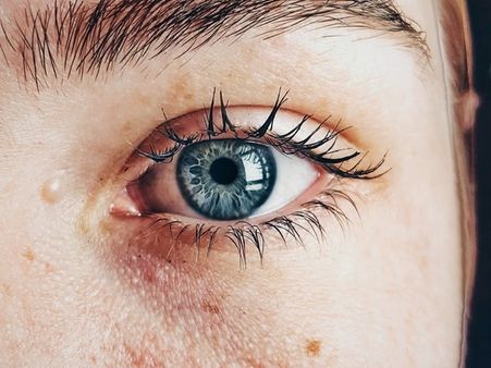 13. Your Skin Is Dry, Flaky, And Itchy