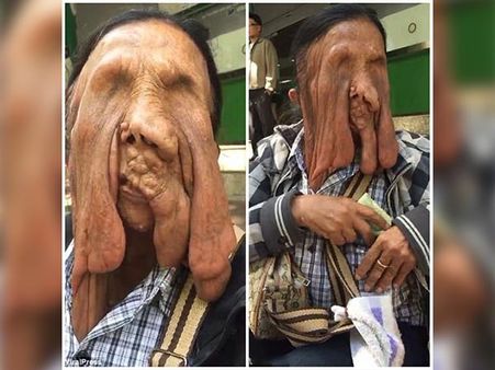 She Suffers From A Rare Condition She Suffers From A Rare Condition