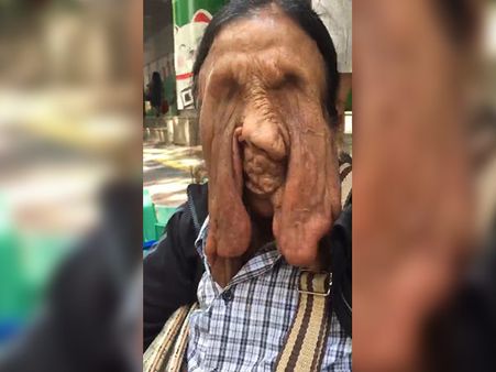 When The Locals Contacted The Health Welfare Association When The Locals Contacted The Health Welfare Association