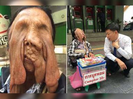 Her Fear For Surgery Her Fear For Surgery