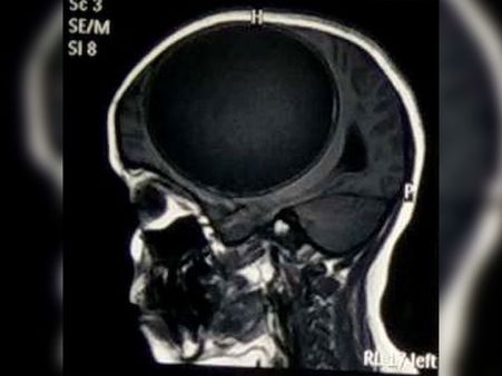 Her Condition Was Getting Worse…